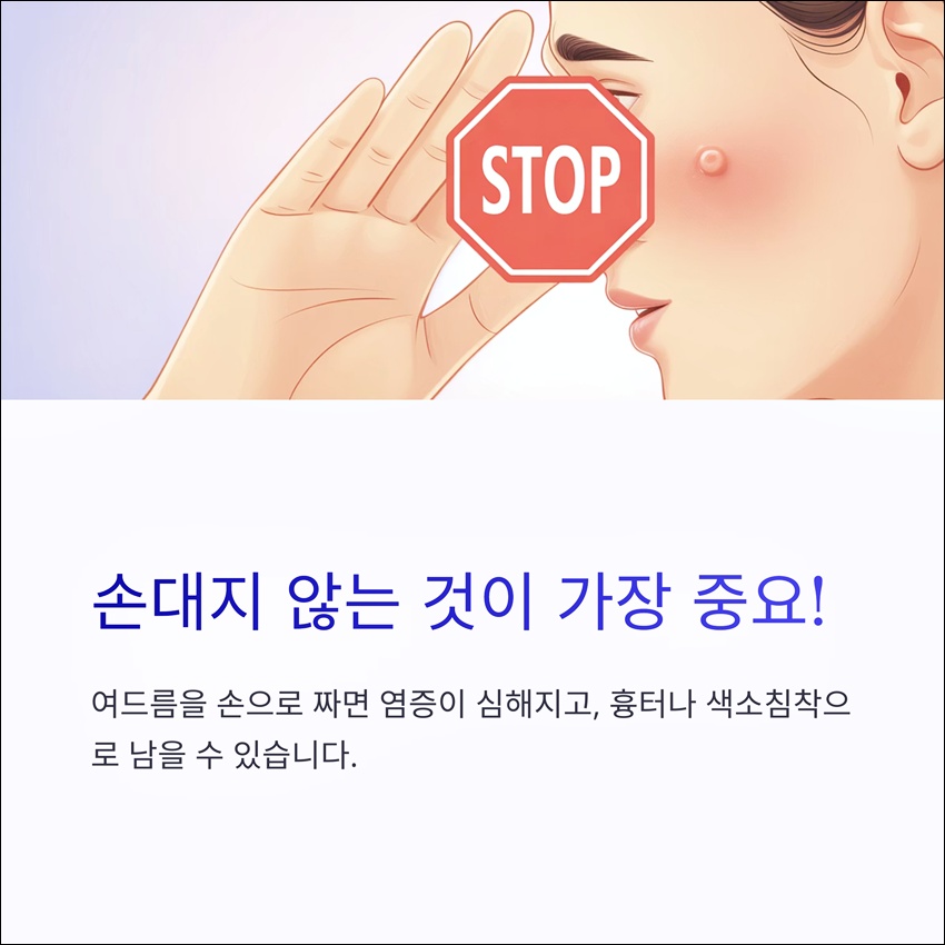 여드름 손대지 말아야 하는 이유