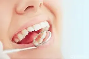 치아