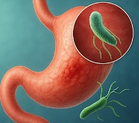헬리코박터균 원인