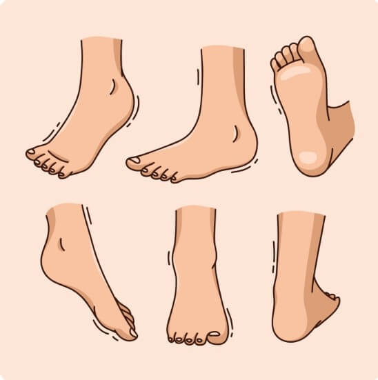 유전적 요인으로 생기는 무지외반증