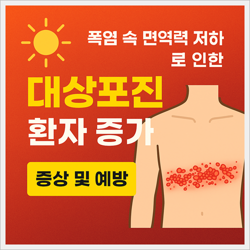 폭염에 의한 대상포진