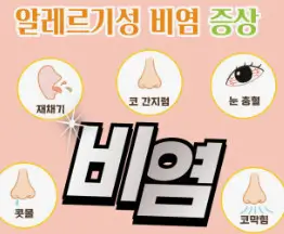 환절기 봄철 목이 칼칼하고 알레르기 비염 증상