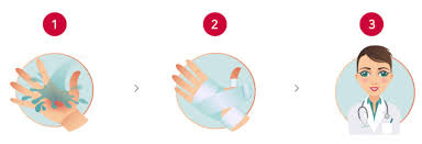 화상 물집 치료방법, 터뜨리지 말고 이렇게 치료하세요!