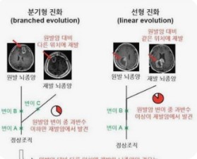 짠음식이 뇌종양악화시키메커니즘 KIST가 최초규명 