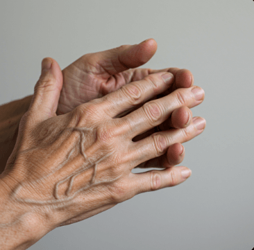 퇴행성관절염 증상 총정리7