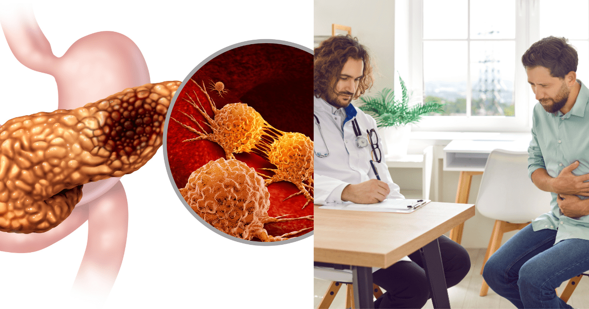 췌장쪽과 박테리아와 의사와 배를 움켜잡은 환자