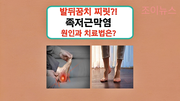 발뒤꿈치 찌릿? 족저근막염의 원인과 치료에 대해서 알아보자!