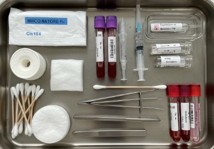 담도암 전증상 및 항암치료