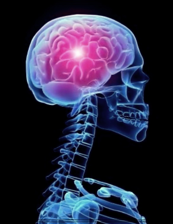 청신경초종 후유증 무슨 종양일까? 원인, 이유, 해결책