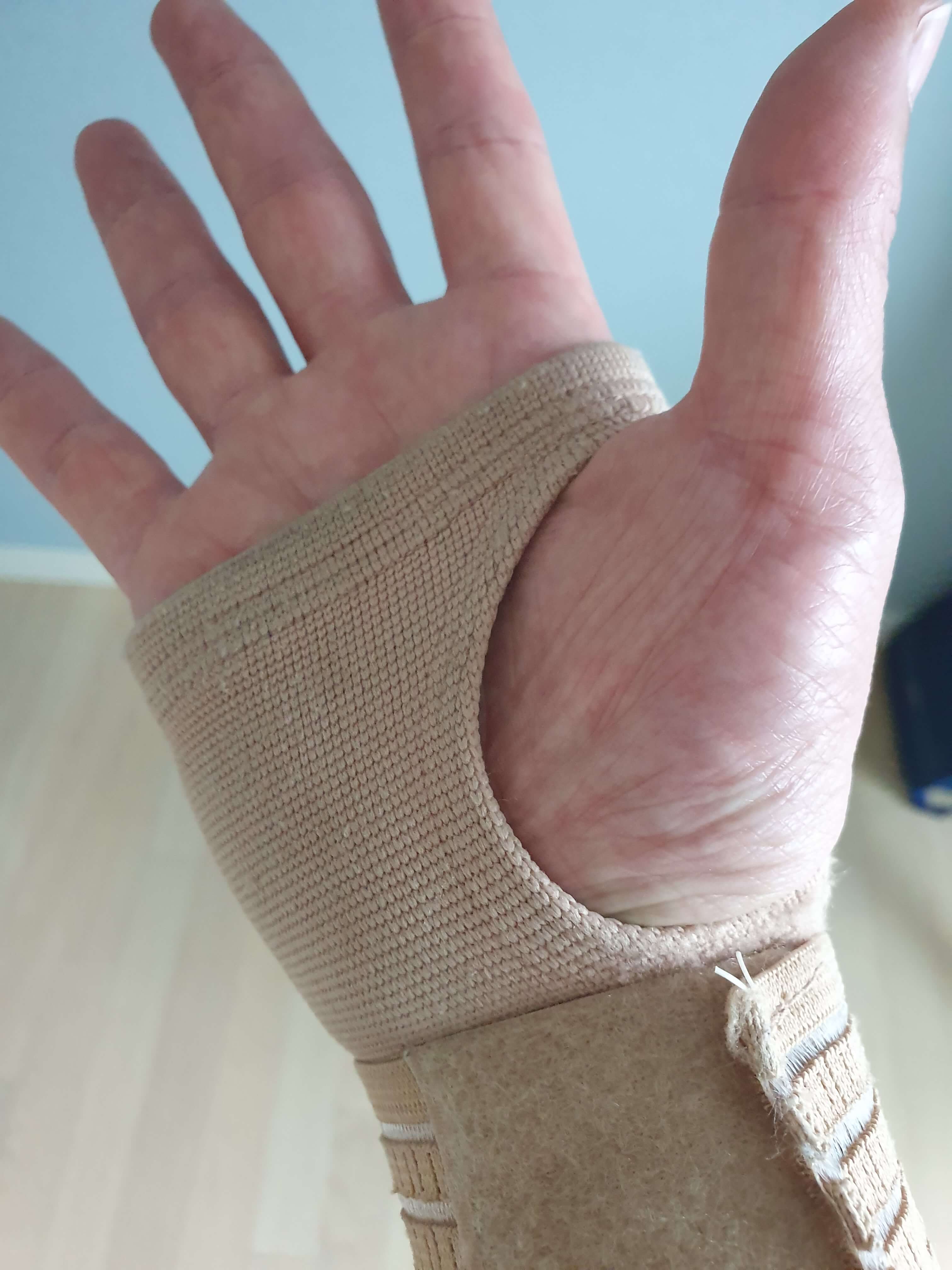 손등-통증-완화-압박붕대-사용