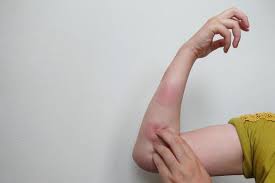 몸이 가려운 이유