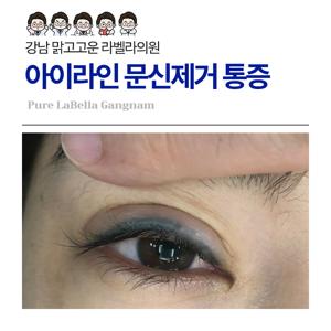 아이라인 제거