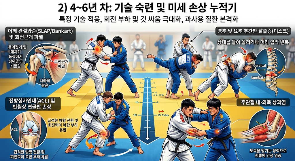 4~6년 차 유도 선수의 과사용 손상인 어깨 관절와순, 무릎 십자인대, 척추 디스크, 팔꿈치 상과염 정리 인포그래픽.