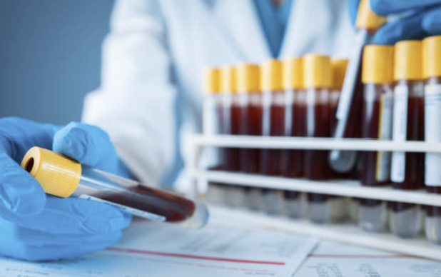 Endogenous Metabolite Interference 최소화를 위한 방법 개발 전략