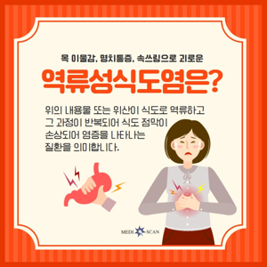 역류성식도염증상
