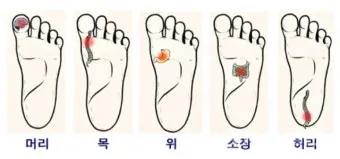 발바닥 파스 효과와 붙이는 위치 방법 팁 정리_5
