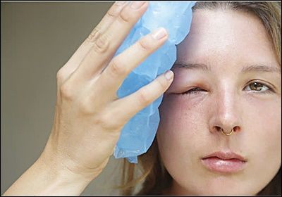 눈꺼풀이 붓는 이유