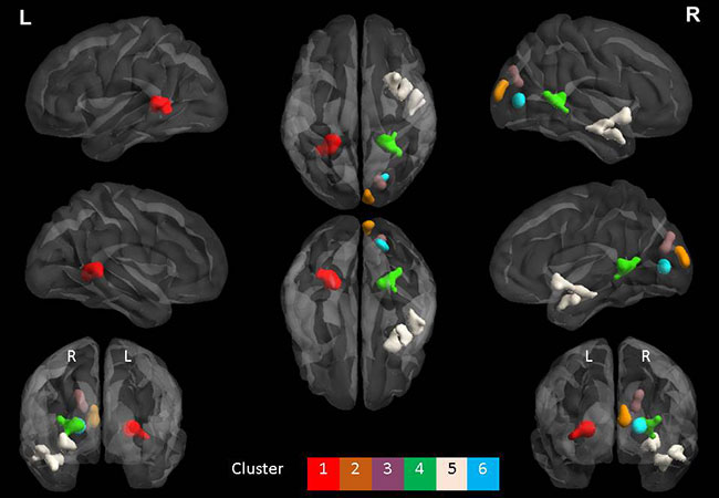 후각-기억-연관-관계-연구-결과-뇌-MRI