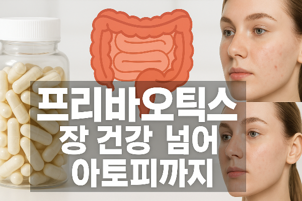 프리바이오틱스 장건강