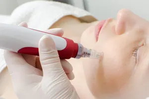 검버섯-없애는-방법