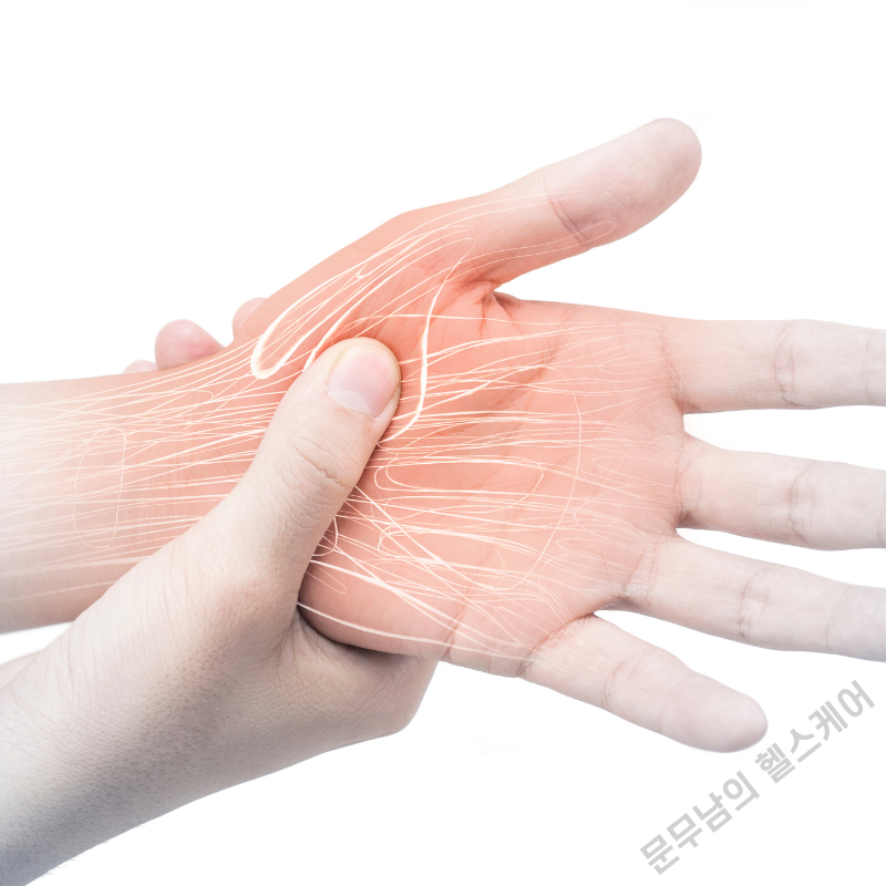 엄지손가락 인대 늘어남 증상 치료법