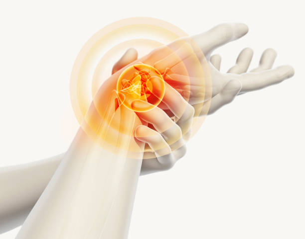 손목터널증후군
