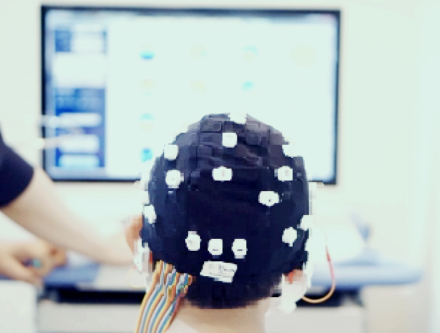 뇌기능 검사 사진