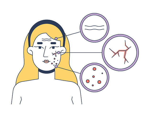 복합성 피부 (Combination Skin)