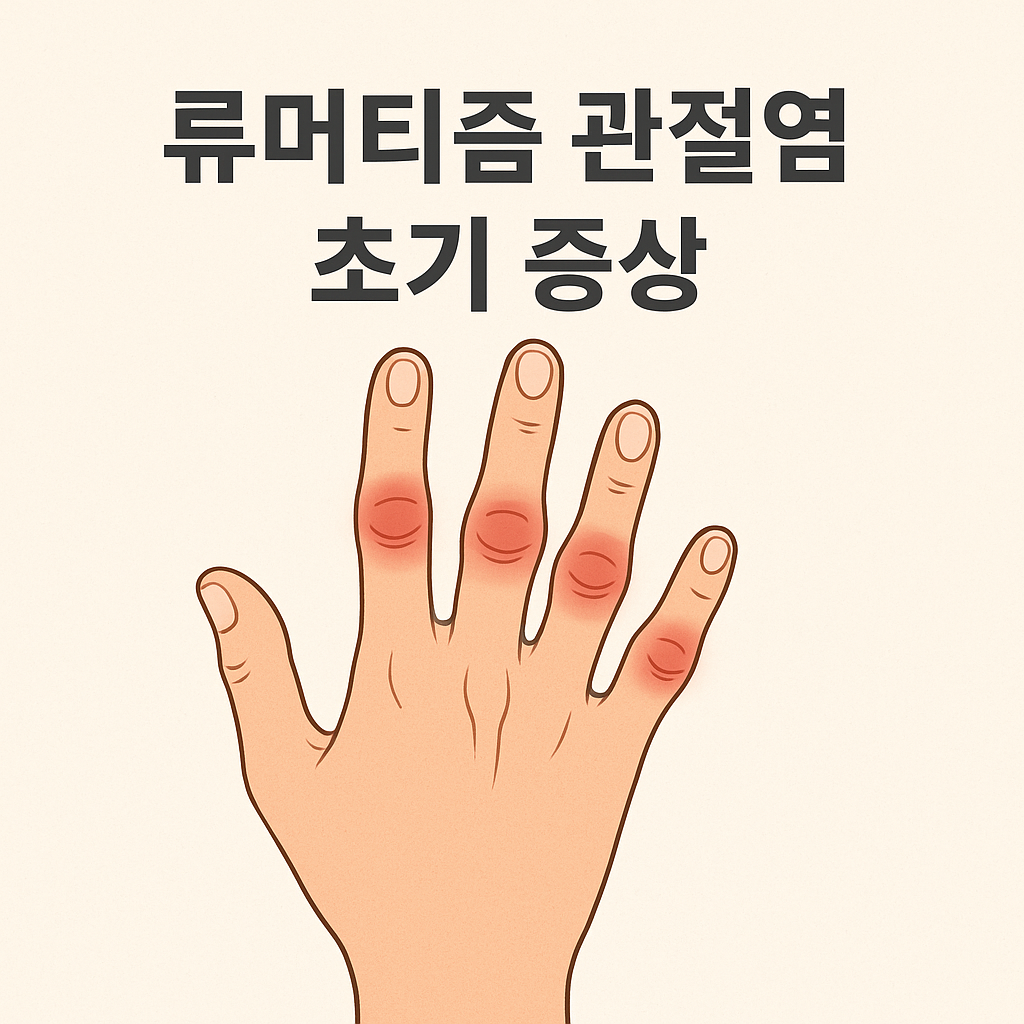 류머티즘 관절염 초기 증상 🚨 놓치면 큰일 납니다