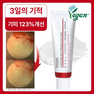 기미 잡티 크림 추천