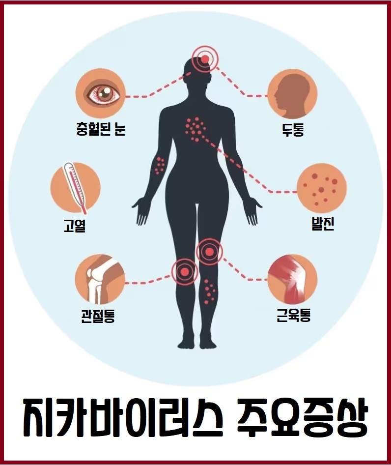 지카바이러스 증상