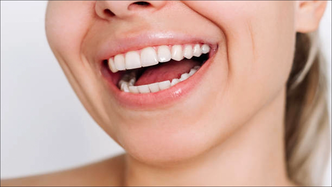 스케일링 비용 스케일링 후 식사 스케일링 주기 스케일링 술 담배 커피 음식 통증 피 잇몸 시림 부음