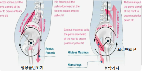 골반이미지