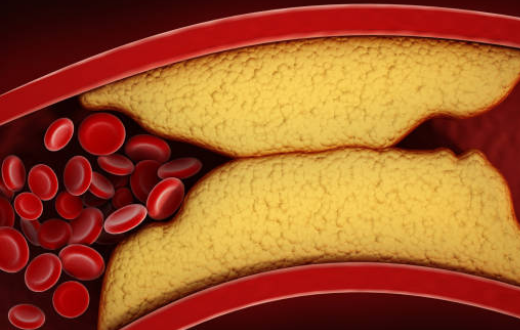 콜레스테롤 낮추는 음식