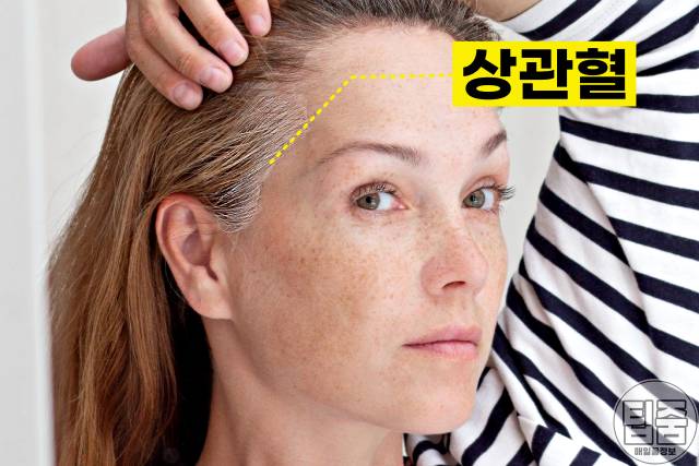 흰머리 나는 부위 고혈압 흰머리 부위별 원인