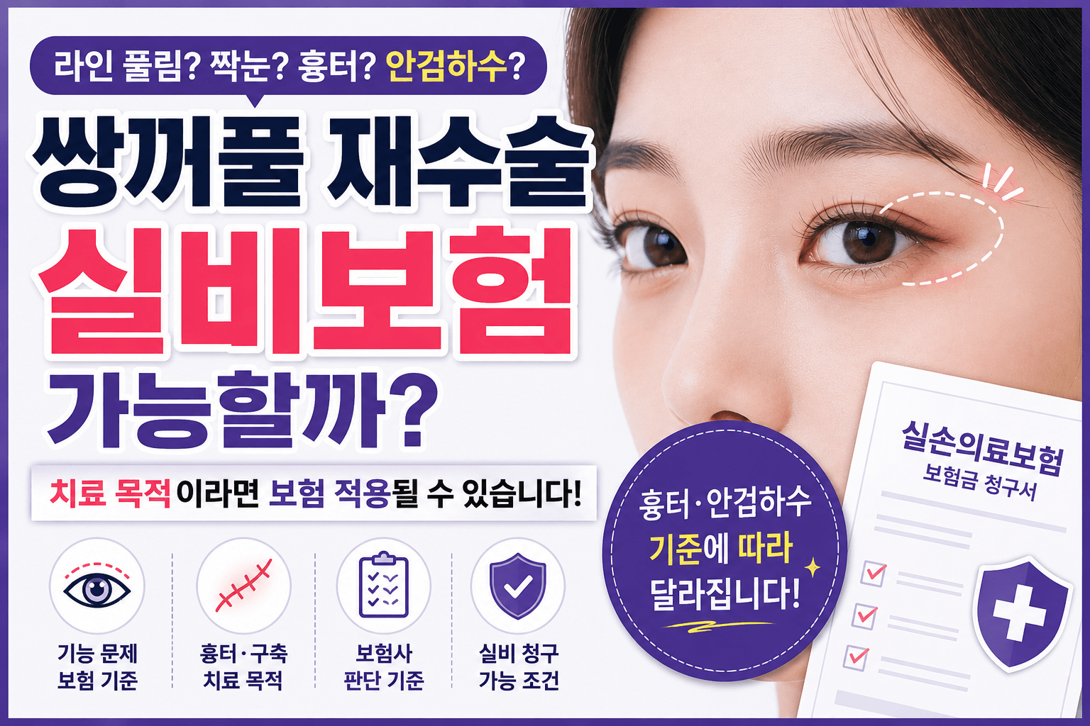 쌍커풀 재수술 실비 가능할까?