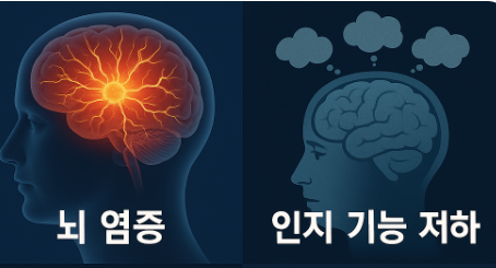 뇌 염증 인지 기능 저하