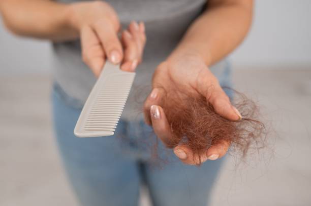 탈모 영양제 복용 시 주의할 점