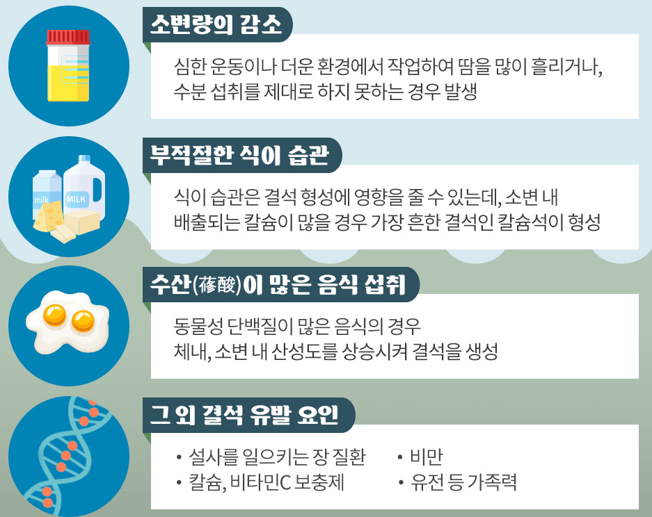 요로결석 증상, 원인, 치료방법