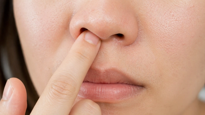 코딱지가 자주 생기는 이유