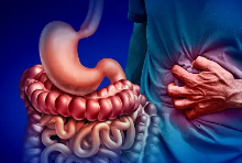 과민성 대장 증후군 증상