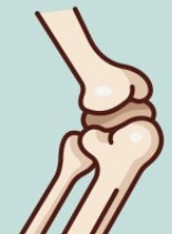 연골연화증 운동