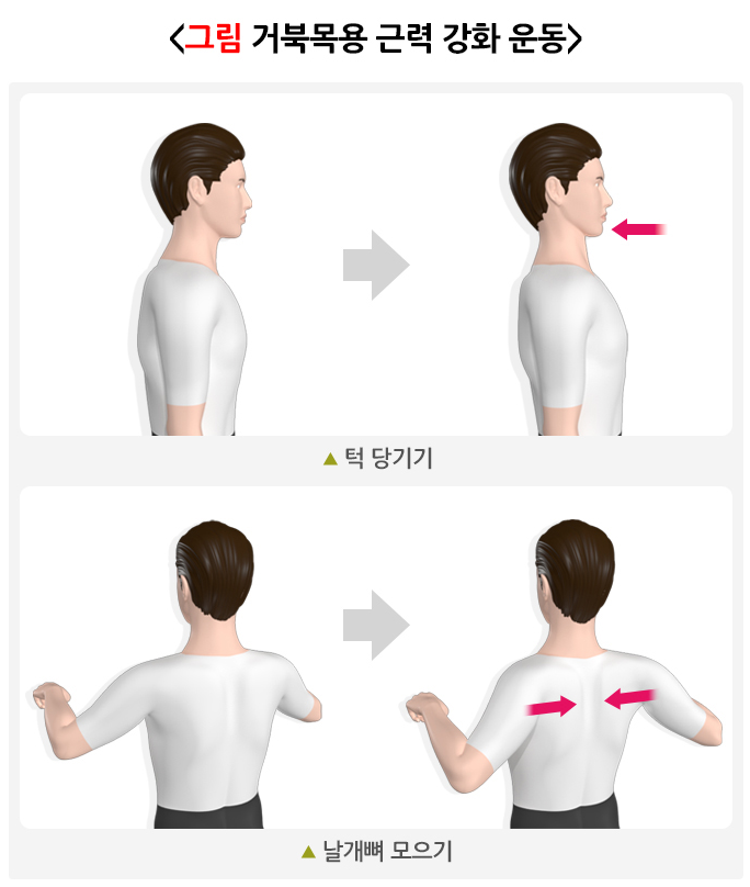 거북목 운동 및 스트레칭