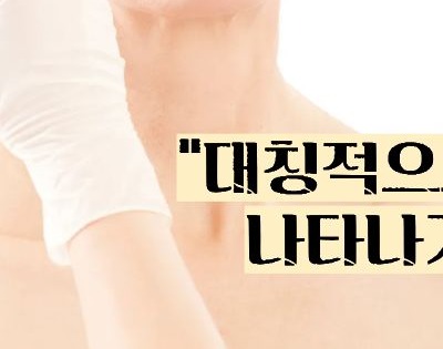 백반증 초기증상