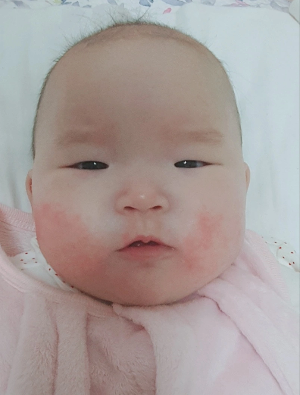 우리아이를 위한 놓치면 안될 아토피로션