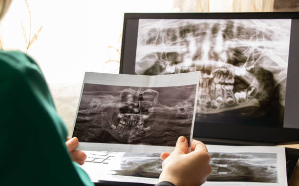 턱교정 잘하는 선택기준 장비