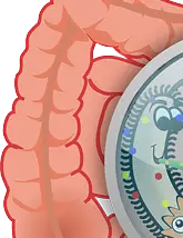 장이 부었을 때 증상, 원인, 해결방법까지! 지금 바로 확인하세요.