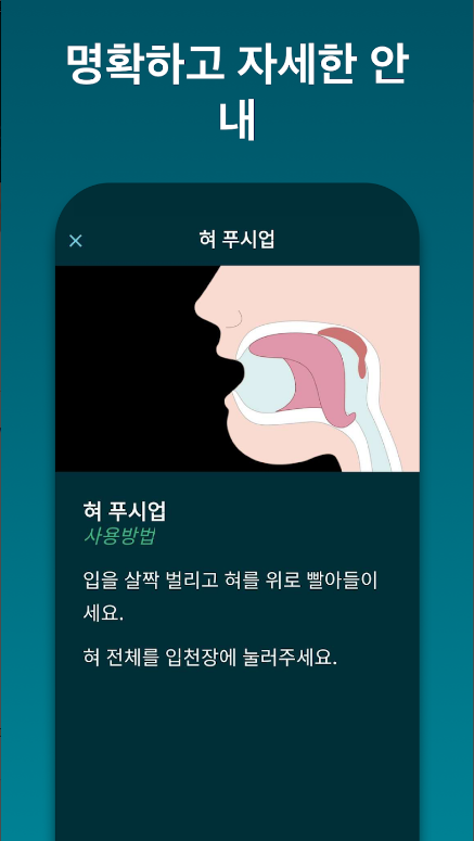 코골이, 코골이 치료, 코골이 원인, SnoreGym, 코골이 감소를 위한 필수 운동 어플