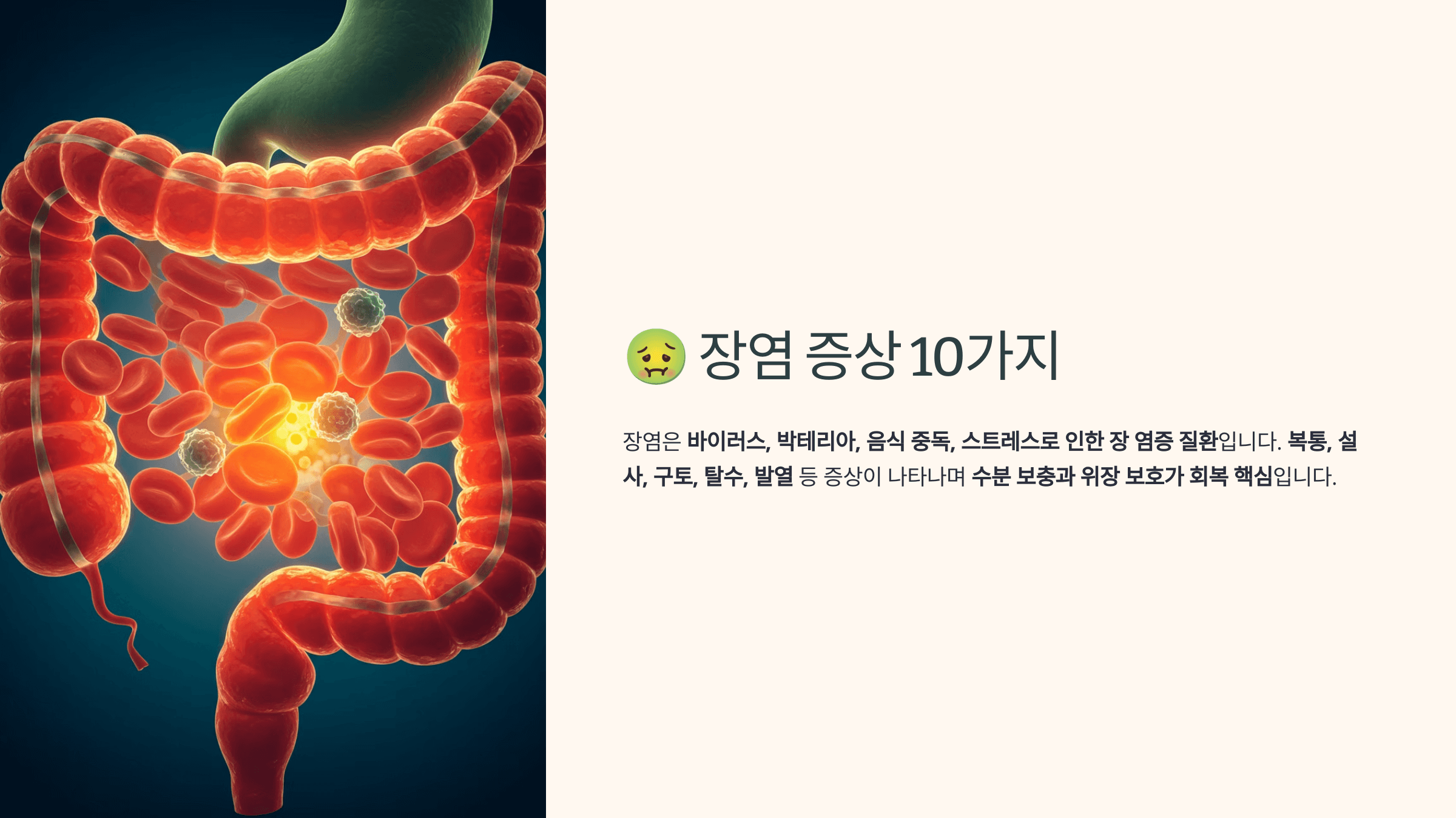 장염과 관련된 사진입니다.