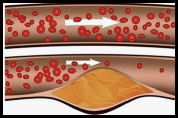 폴리코사놀 복용법